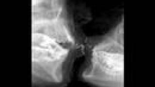 The (after)life of the party-Fall Out Boy