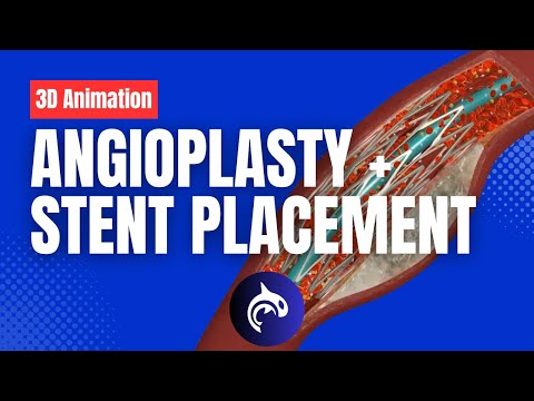 The Difference Between Cardiac Arrest Heart Attack and Heart Failure 3D Animation