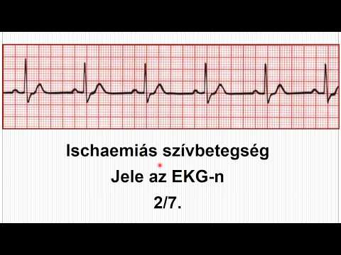 végezzen magas vérnyomás tesztet házipatika magas vérnyomás ellen