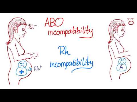 ABO incompatibility vs. Rh incompatibility