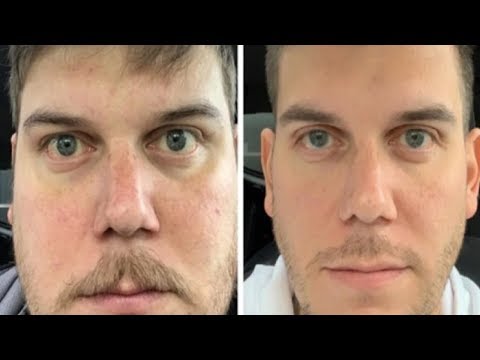 download lagu mp3 mp4 Does Not Drinking Alcohol Make You Look Younger, download lagu Does Not Drinking Alcohol Make You Look Younger gratis, unduh video klip Does Not Drinking Alcohol Make You Look Younger