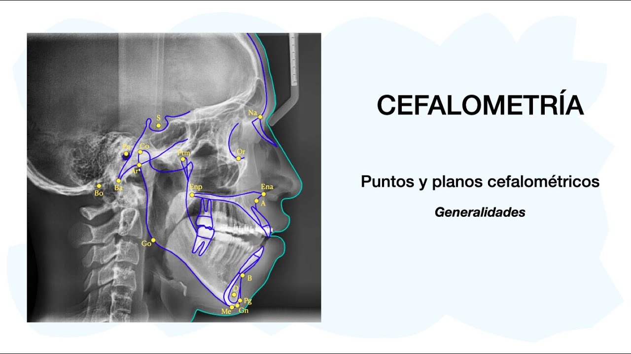 PUNTOS CEFALOMÉTRICOS - Cefalometría 💀🦷✅