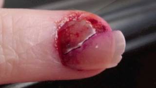 I RIPPED UP MY NAIL!!!