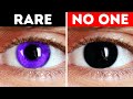 That's Why People Don't Have Black Eyes (Never Ever)