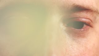 What It&#39;s Like To Go Blind