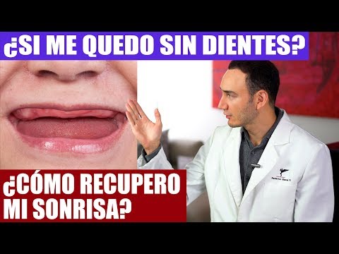 SI ME QUEDO SIN DIENTES, ¿QUÉ OPCIONES TENGO PARA SONREIR Y MASTICAR DE NUEVO? | Dentadura implantes