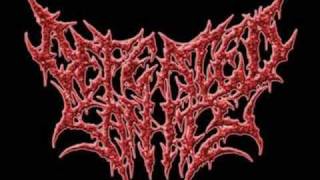 Defeated Sanity - The Parasite
