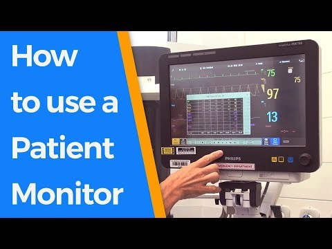 image-What vital signs does a patient monitor record? 