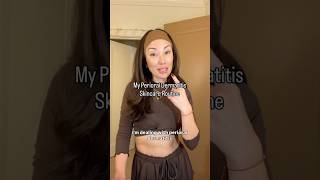 My Skincare Routine for Perioral Dermatitis!