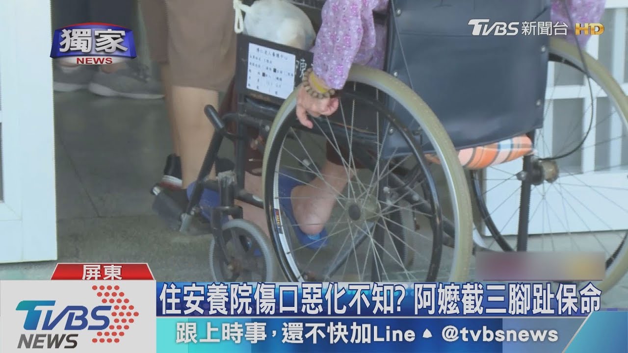 住安養院傷口惡化不知？　阿嬤截三腳趾保命