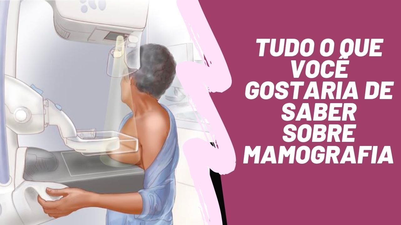 Douglas Soltau Gomes-18