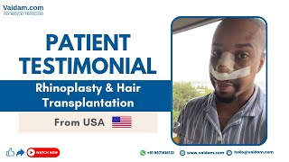 Ринопластика в Турции | Довольный пациент из США