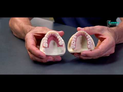 Hochwertiger Zahnersatz muss nicht teuer sein - Zahnprothesen im Vergleich