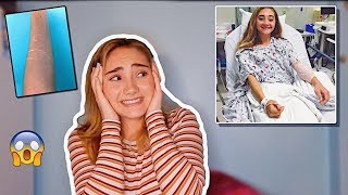 WHAT HAPPENED TO MY ARM!