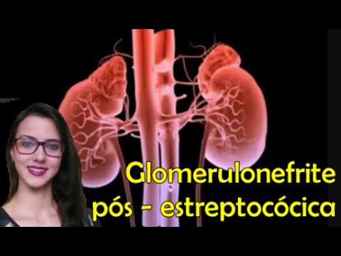 Selezionare ciò operazione per adenoma prostatico Il drenaggio della prostata è