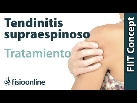 Tratamiento de la tendinitis de hombro o supraespinoso derecho