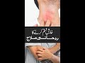 Kharish Ka Rohani Ilaj Best Wazifa For Itchy Skin Treatment Quranic Dua For Skin Allergy Urdu
