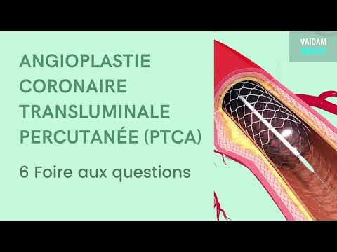 ANGIOPLASTIE CORONAIRE TRANSLUMINALE PERCUTANÉE (PTCA)