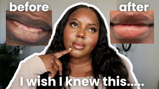 7 (IMPORTANT) things I WISH I knew before getting my lips NEUTRALIZED