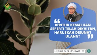 Download lagu Bentuk Kemaluan Seperti Telah Dikhitan, Haruskah Disunat Ulang? | Buya Yahya Menjawab mp3 Download lagu Bentuk Kemaluan Seperti Telah Dikhitan, Haruskah Disunat Ulang? | Buya Yahya Menjawab mp3