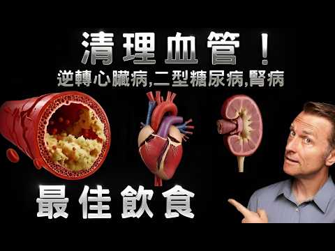 清血管這樣吃就對了！逆轉三高、改善心臟病、糖尿病、慢性腎臟病的科學飲食法 (清血管這樣吃就對了！逆轉三高、改善心臟病、糖尿病、慢性腎臟病的科學飲食法)