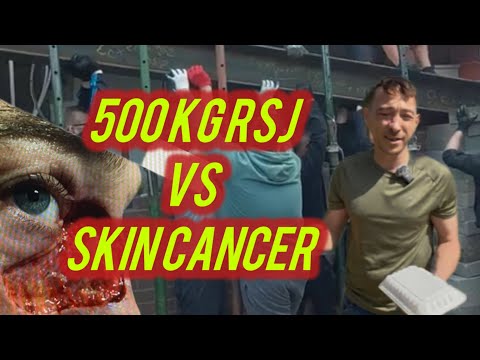 500 kg steel RSJ vs skin Cancer