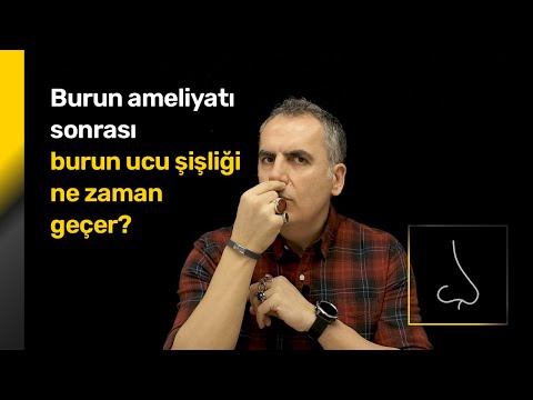 , title : 'Burun estetiği ameliyatı sonrası burun ucu şişliği ne zaman geçer? - Orhan Murat Özdemir'