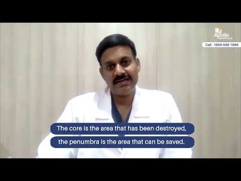 Acute Ischemic Stroke Treatment | Dr S Rajesh Reddy, Neuro Surgeon | Apollo Hospitals, Hyderabad