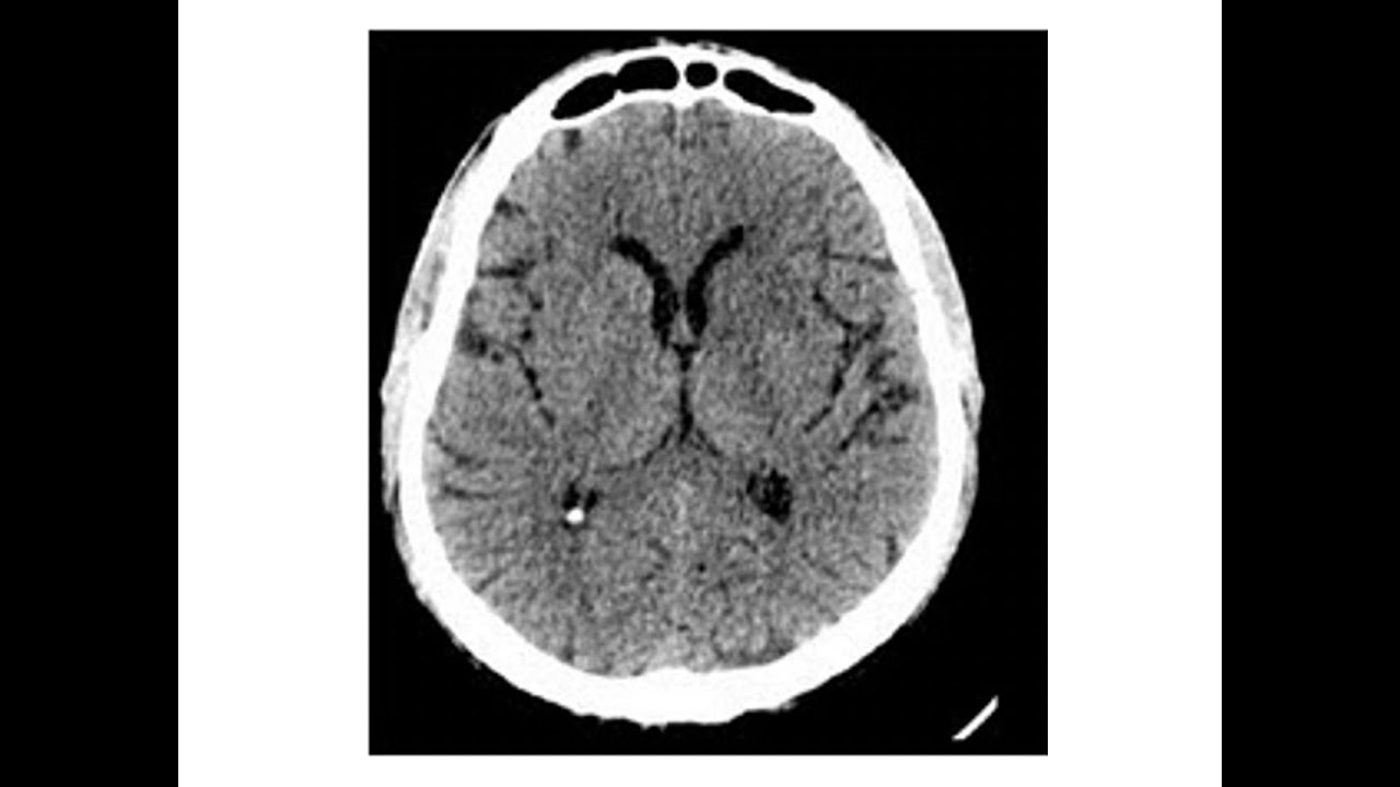 Imagem do Sistema Ventricular
