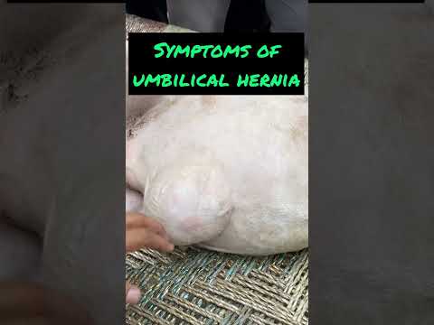 , title : 'Umbilical hernia in calf l Dr umar khan'