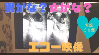 エコー映像 男の子かな 女の子かな 性別再び聞いてみた 妊娠週 موقع ويب حيث يمكنك مشاهدة مقاطع فيديو موسيقية مجانية