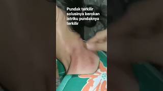 Download lagu suami kerokan istri#shorts mp3