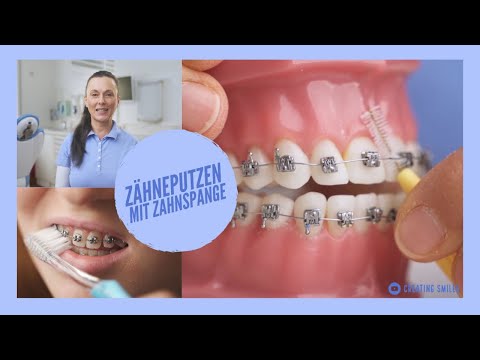 Zähneputzen mit Brackets - Unsere Tipps um die Zahnspange richtig sauber zu bekommen