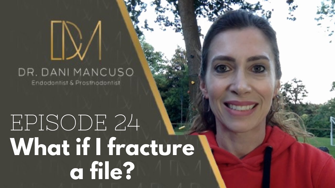 The Diary of an Endodontist - Episode 24 – What if I fracture a file?