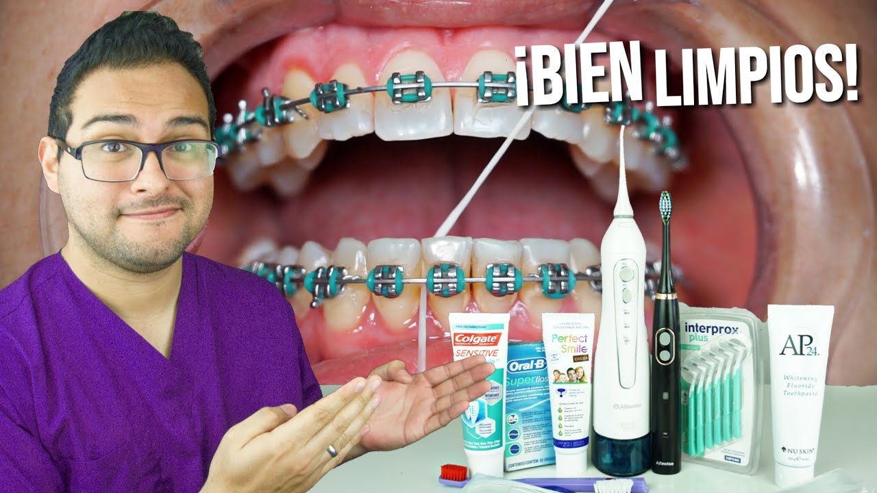 ¡COMO CEPILLARSE LOS DIENTES 👅 CON BRACKETS! La GUIA MAXIMA 2019 🙌