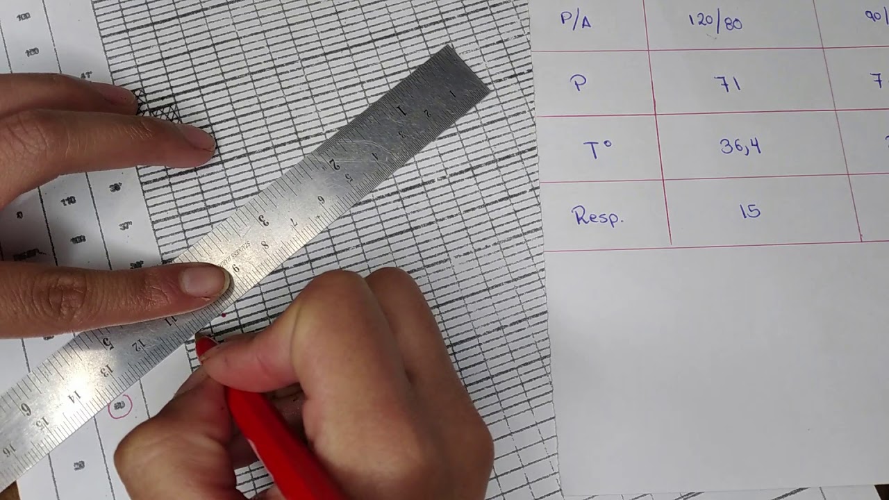 HOJA GRÁFICA DE CONTROLES VITALES