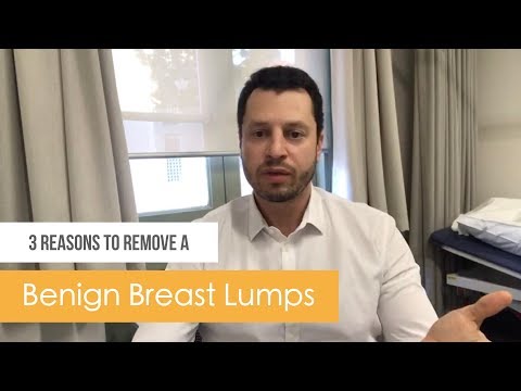3 Reasons to remove a benign breast lumps
