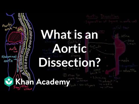 What is an aortic dissection? | Circulatory System and Disease | NCLEX-RN | Khan Academy