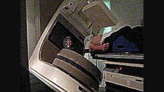 [UNEDITED] mouth cancer radiation therapy / clinical linear accelerator