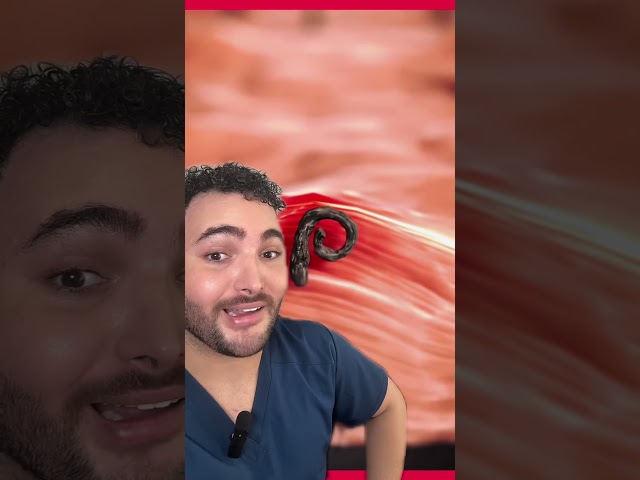 Vídeo relacionado con First Aid Beauty Discos para Vellos Encarnados con BHA y AHA, Tratamiento Preventivo del Vello Encarnado que Alivia el Ardor de la Maquinilla de Afeitar, Uso Diario (60 almohadillas)