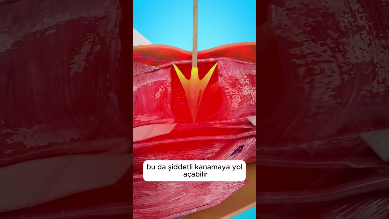 Neden Bir Oku Çıkarmamalısınız 😣