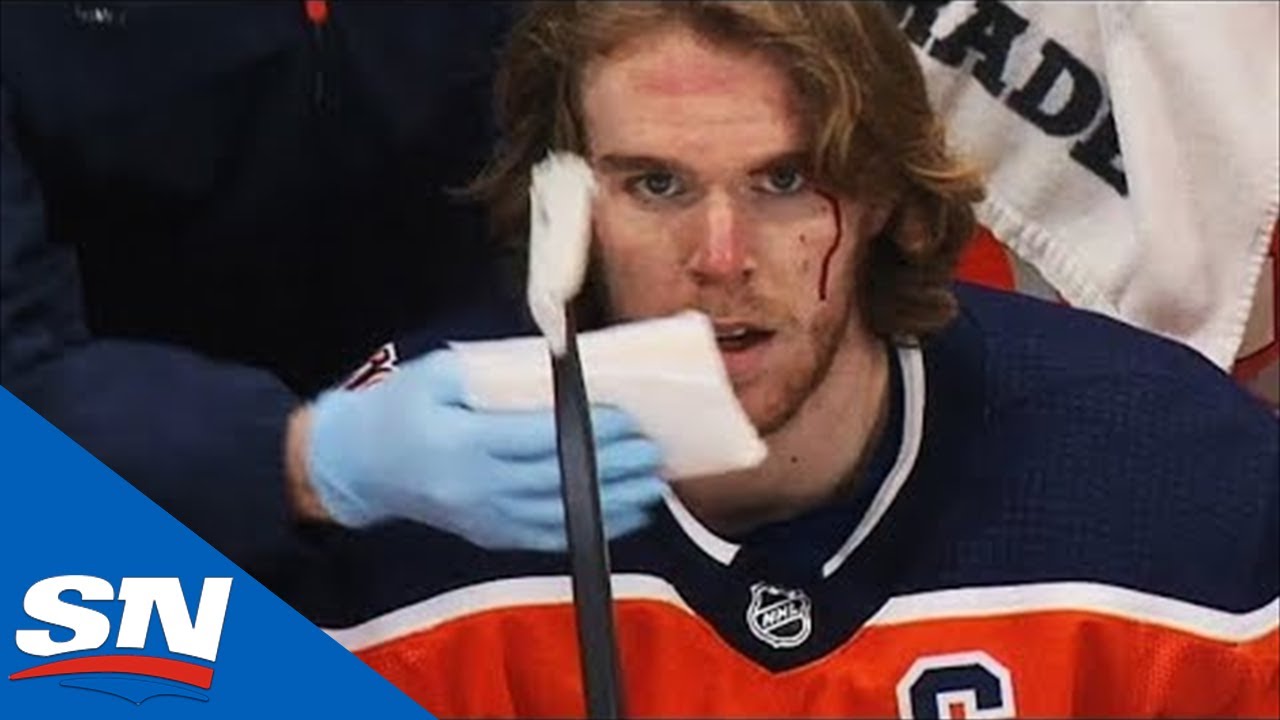 Vidéo: Connor McDavid ENSANGLANTÉ...