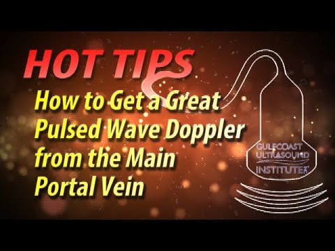 How to Get Great Pulsed Wave Doppler from the Main Portal Vein