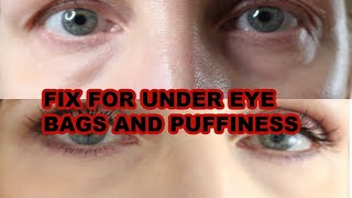 HOW TO GET RID OF BAGS UNDER EYES INSTANTLY!