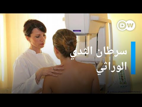 اختبار جيني يقلّص فجوة النجاة من سرطان الثدي على أساس العرق 