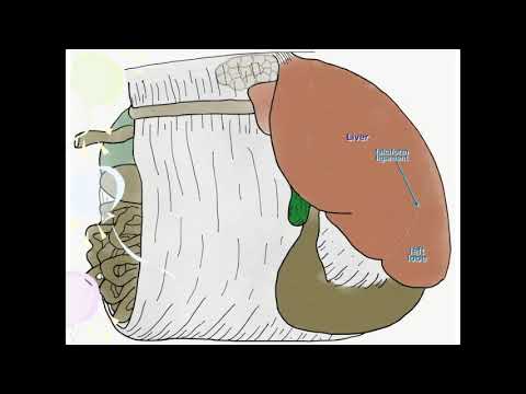 deginimas omentum riebalai pašalinti prijuostės riebalus