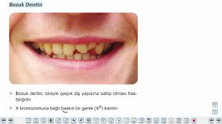 Eğitim Vadisi 10.Sınıf Biyoloji 10.Föy Eşey Kromozomlarına Bağlı Kalıtım Konu Anlatım Videoları