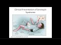 Consult Psychiatry Emergencies: A Review of Medication Toxicity Syndromes and Catatonia Consult Psychiatry Emergencies: A Review of Medication Toxicity Syndromes and Catatonia