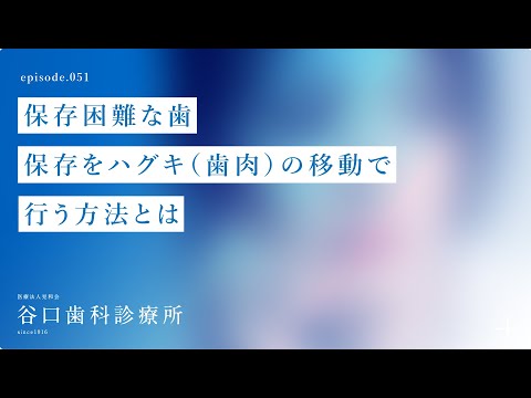 第51話 保存困難な歯を保存をハグキ（歯肉）の移動で行う方法とは⁉️前編-札幌駅前-赤れんがテラス-谷口歯科診療所
