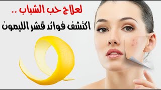 لعلاج حب الشباب .. اكتشف فوائد قشر الليمون لعلاج حب الشباب .. اكتشف فوائد قشر الليمون